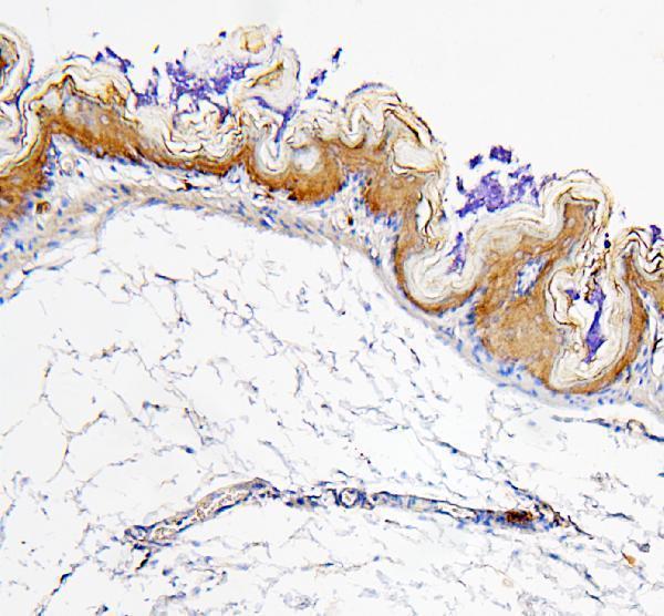 a01392 aldh1a1 primary antibodies ihc testing 5