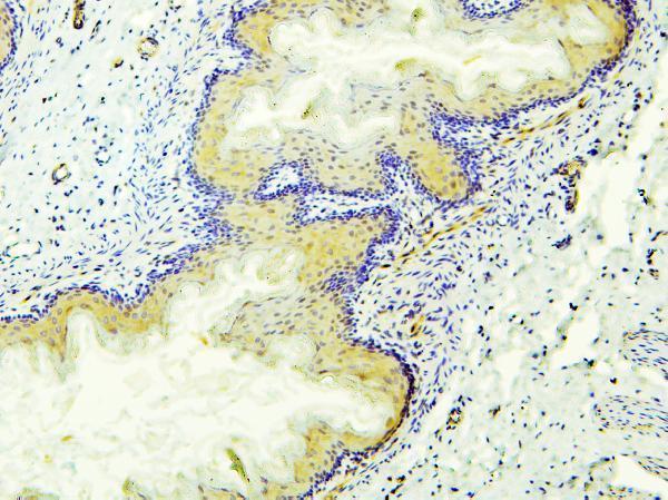 a01392 aldh1a1 primary antibodies ihc testing 6