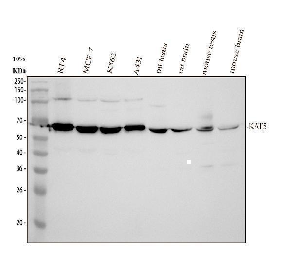 Western blot analysis of Tip60/KAT5 using anti-Tip60/KAT5 antibody (A01393-3)