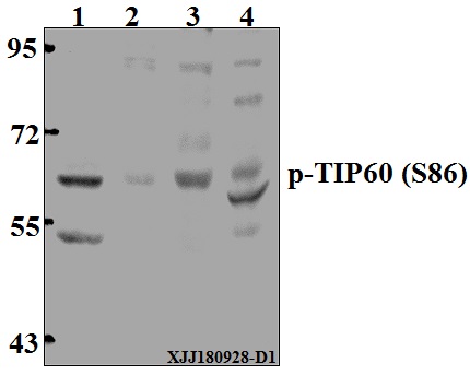 Western blot (WB) analysis of TIP60 (phospho-S86) polyclonal antibody at 1:500 dilution
Lane1:The Kidney tissue lysate of Rat(40µg)
Lane2:A549 whole cell lysate(40µg)
Lane3:HCT116 whole cell lysate(40µg)
Lane4:CT-26 whole cell lysate(40µg)