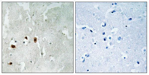 a01393s90 kat5 primary antibodies ihc testing 2