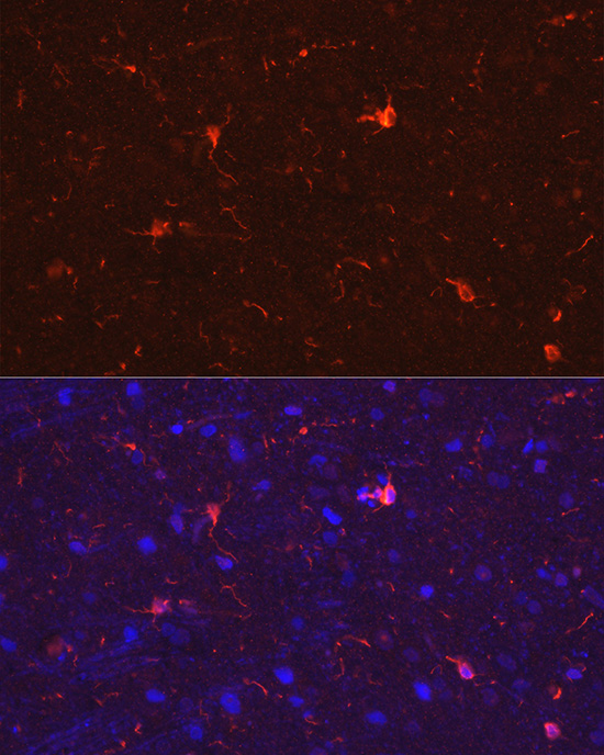 Immunofluorescence analysis of rat brain cells using IBA1 pAb at dilution of 1:50 (40x lens)