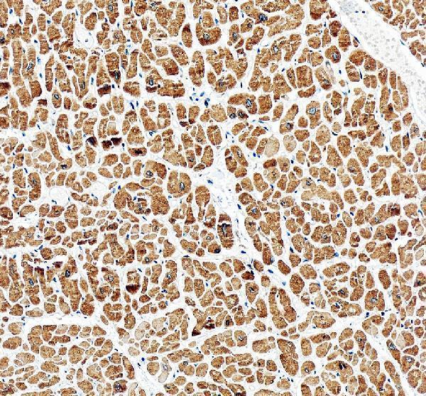 IHC analysis of Phospholamban/PLN using anti-Phospholamban/PLN antibody (A01395-1)