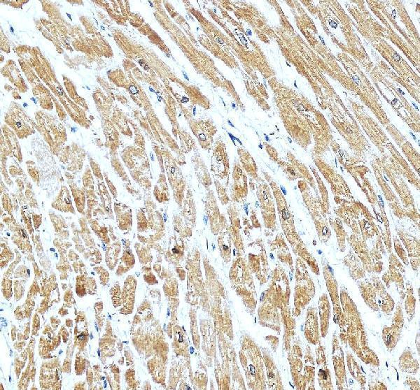 IHC analysis of PLB/PLN using anti-PLB/PLN antibody (A01395-1)