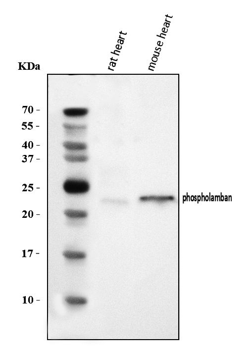  Western blot analysis of Phospholamban/PLN using anti-Phospholamban/PLN antibody (A01395-1)