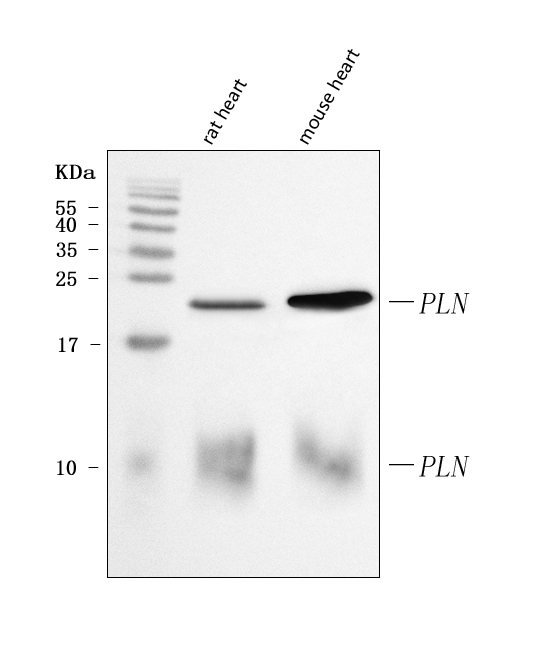  Western blot analysis of PLN using anti-PLN antibody (A01395-2)