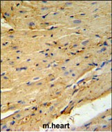 PLB-T17 Antibody IHC analysis in formalin fixed and paraffin embedded mouse heart tissue followed by peroxidase conjugation of the secondary antibody and DAB staining