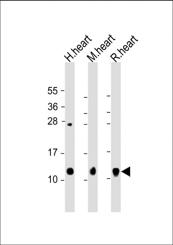 All lanes : Anti-PLB Antibody at 1:2000 dilutionLane 1: human heart lysateLane 2: mouse heart lysateLane 3: rat heart lysateLysates/proteins at 20 µg per lane