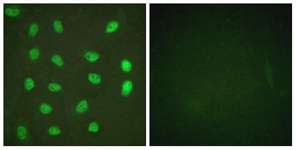 a01398s408 mef2a primary antibodies if testing 5