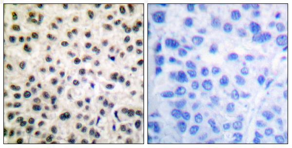 a01398s408 mef2a primary antibodies ihc testing 4