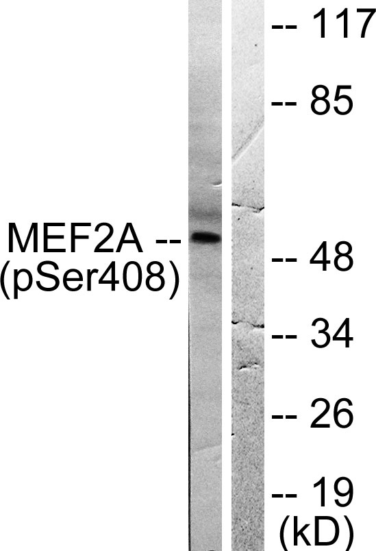 a01398s408 mef2a primary antibodies wb testing 3