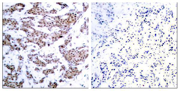 a01398t312 1 mef2a primary antibodies ihc testing 1