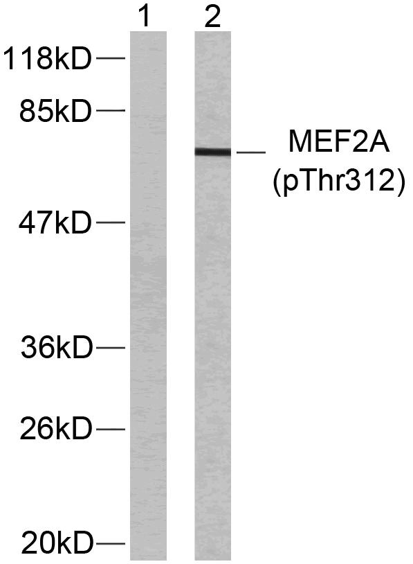 a01398t312 1 mef2a primary antibodies wb testing 2