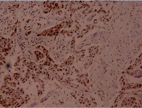 a01398t312 mef2a primary antiboties ihc testing 2