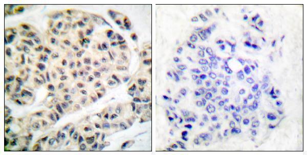 a01398t319 mef2a primary antibodies ihc testing 1