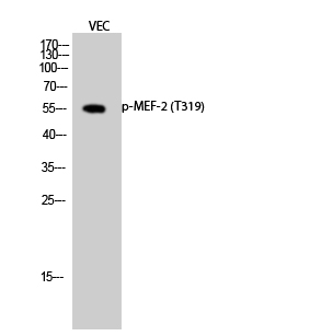 a01398t319 mef2a primary antibodies wb testing 2