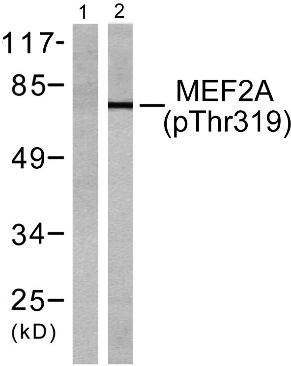 a01398t319 mef2a primary antibodies wb testing 3