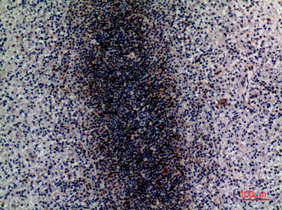 a01399 cd79b primary antibodyes ihc testing 2