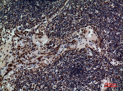 a01399 cd79b primary antibodyes ihc testing 3