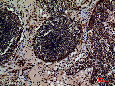 a01399 cd79b primary antibodyes ihc testing 4