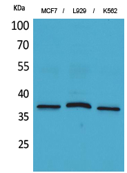 a01399 cd79b primary antibodyes wb testing 1