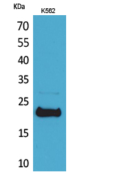Western blotting validation for Anti-Leukemia inhibitory factor LIF Antibody A01400-1
Western Blot (WB) analysis of K562 cells using LIF polyclonal antibody