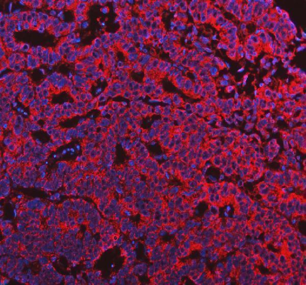 IF analysis of MTRR using anti-MTRR antibody (A01401-1)