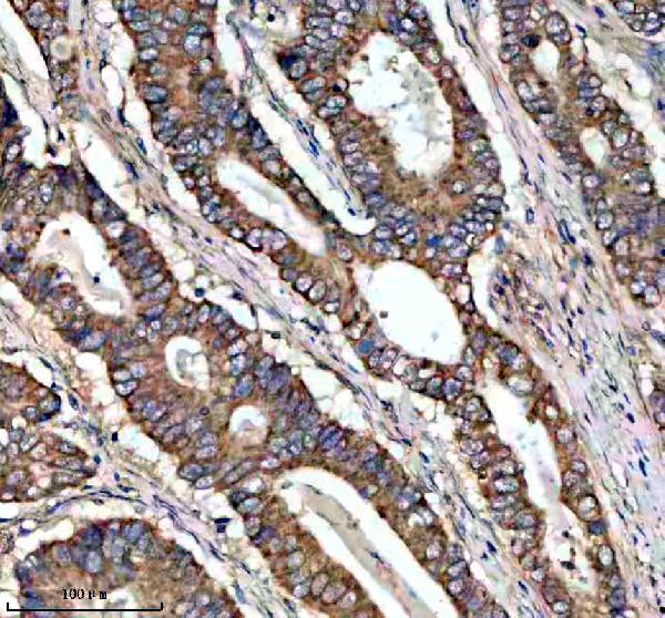 IHC analysis of MTRR using anti-MTRR antibody (A01401-1)