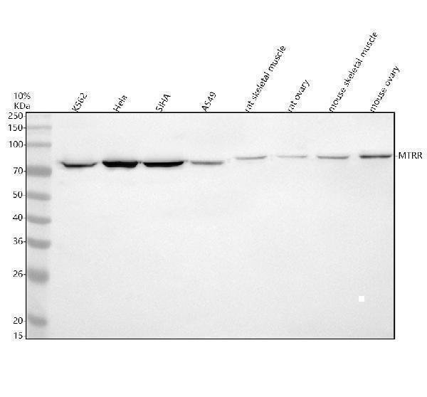 Western blot analysis of MTRR using anti-MTRR antibody (A01401-1)