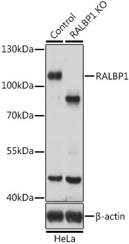 a01403 ralbp1 primary antiboties wb testing 2