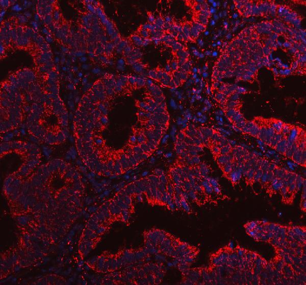 a01404 1 ivd primary antibodies if testing 1
