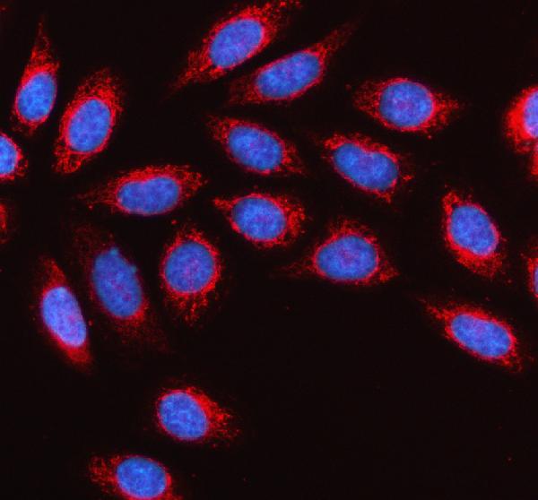 a01404 1 ivd primary antibodies if testing 2