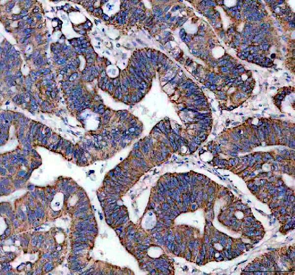 IHC analysis of IVD using anti-IVD antibody (A01404-1)