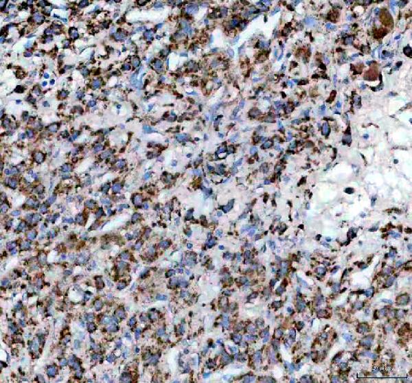IHC analysis of IVD using anti-IVD antibody (A01404-1)