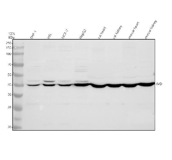 Western blot analysis of IVD using anti-IVD antibody (A01404-1)