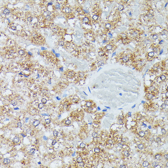 a01404 ivd primary antiboties ihc testing 2