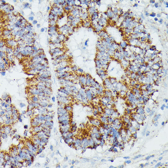 a01404 ivd primary antiboties ihc testing 3