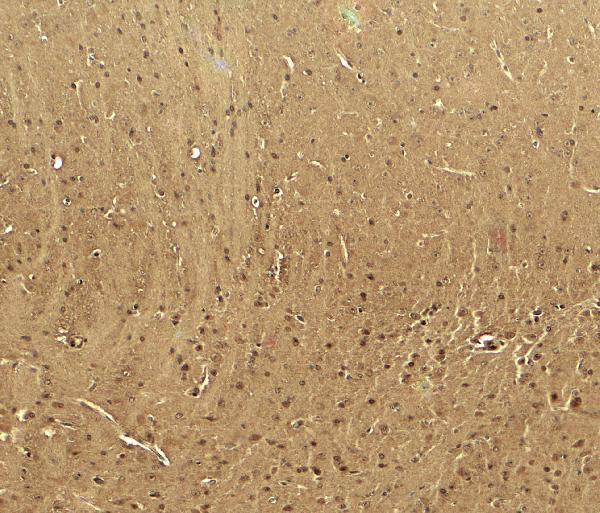 a01406 1 cacna1h primary antibodies ihc testing 2
