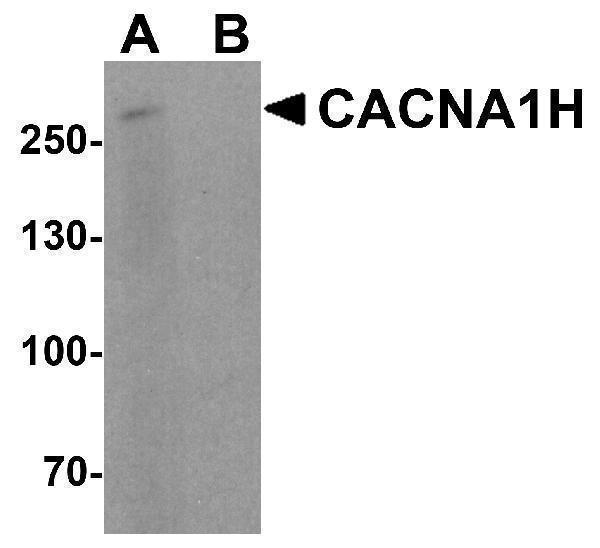 a01406 1 cacna1h primary antibodies wb testing 1