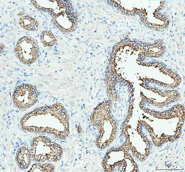 IHC analysis of CPE using anti-CPE antibody (A01407-2)