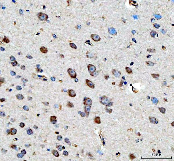 IHC analysis of CPE using anti-CPE antibody (A01407-2)