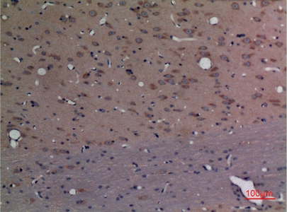 Immunohistochemistry (IHC) analysis of paraffin-embedded Rat Brain, antibody was diluted at 1:100