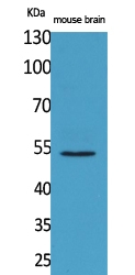 Western Blot (WB) analysis of Mouse Brain cells using CPE Polyclonal antibody