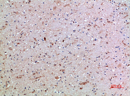 Immunohistochemical analysis of paraffin-embedded human-brain, antibody was diluted at 1:200