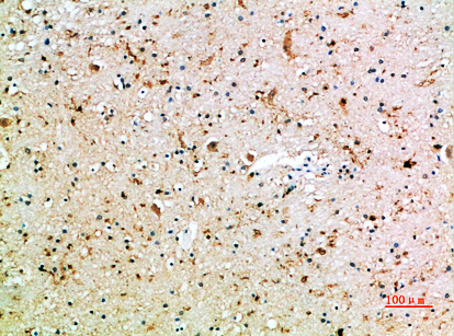 Immunohistochemical analysis of paraffin-embedded human-brain, antibody was diluted at 1:200