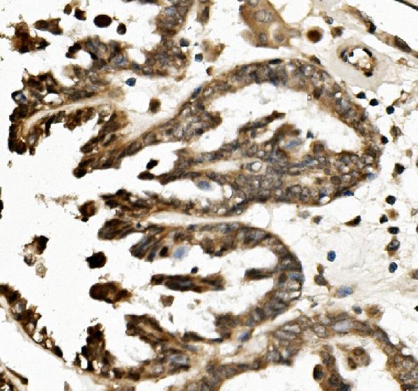 a01409 1 txnip primary antibodies ihc testing 2
