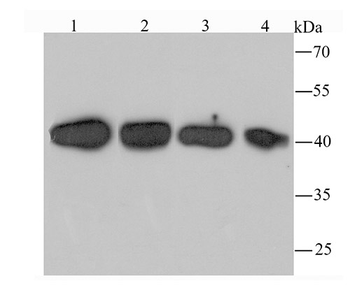 Western blot analysis of TXNIP on different lysates using anti-TXNIP antibody at 1/1,000 dilution