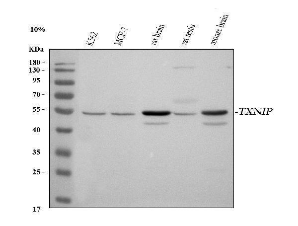  Western blot analysis of TXNIP using anti-TXNIP antibody (A01409-3)