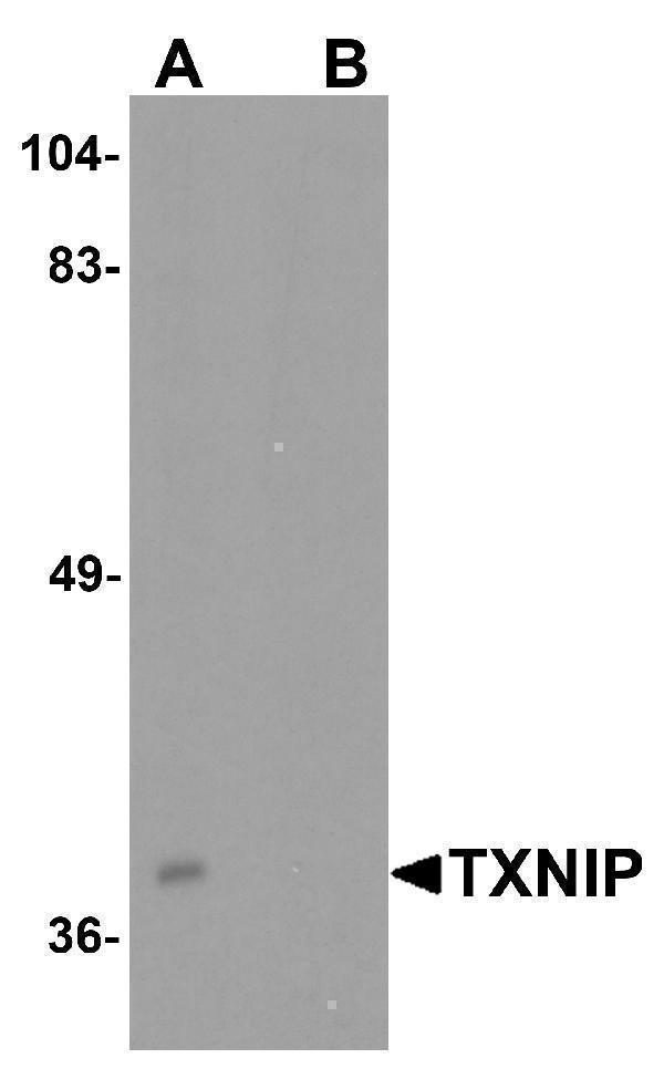 Western blot analysis of TXNIP in C2C12 cell lysate with TXNIP antibody at 0