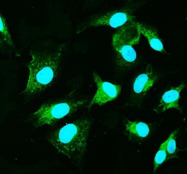 a01410 1 card9 primary antibodies icc testing 3